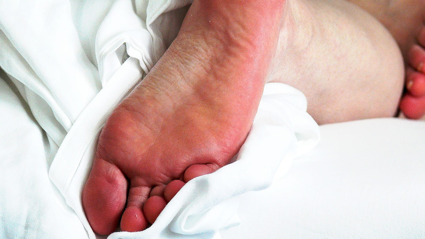足指の付け根が痛い 原因は 中足骨骨頭部痛 その対処法を紹介 大阪 茨木市の巻爪補正専門整体 大阪巻き爪フットケア専門院