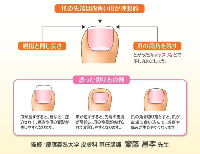 妊娠中の 足の爪切り ってどうする 巻き爪になるリスクもあるので要注意 大阪 茨木市の巻爪補正専門整体 大阪巻き爪フットケア専門院